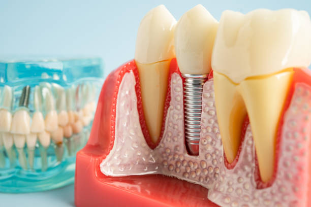 Professional Dental Services in Humboldt, TN